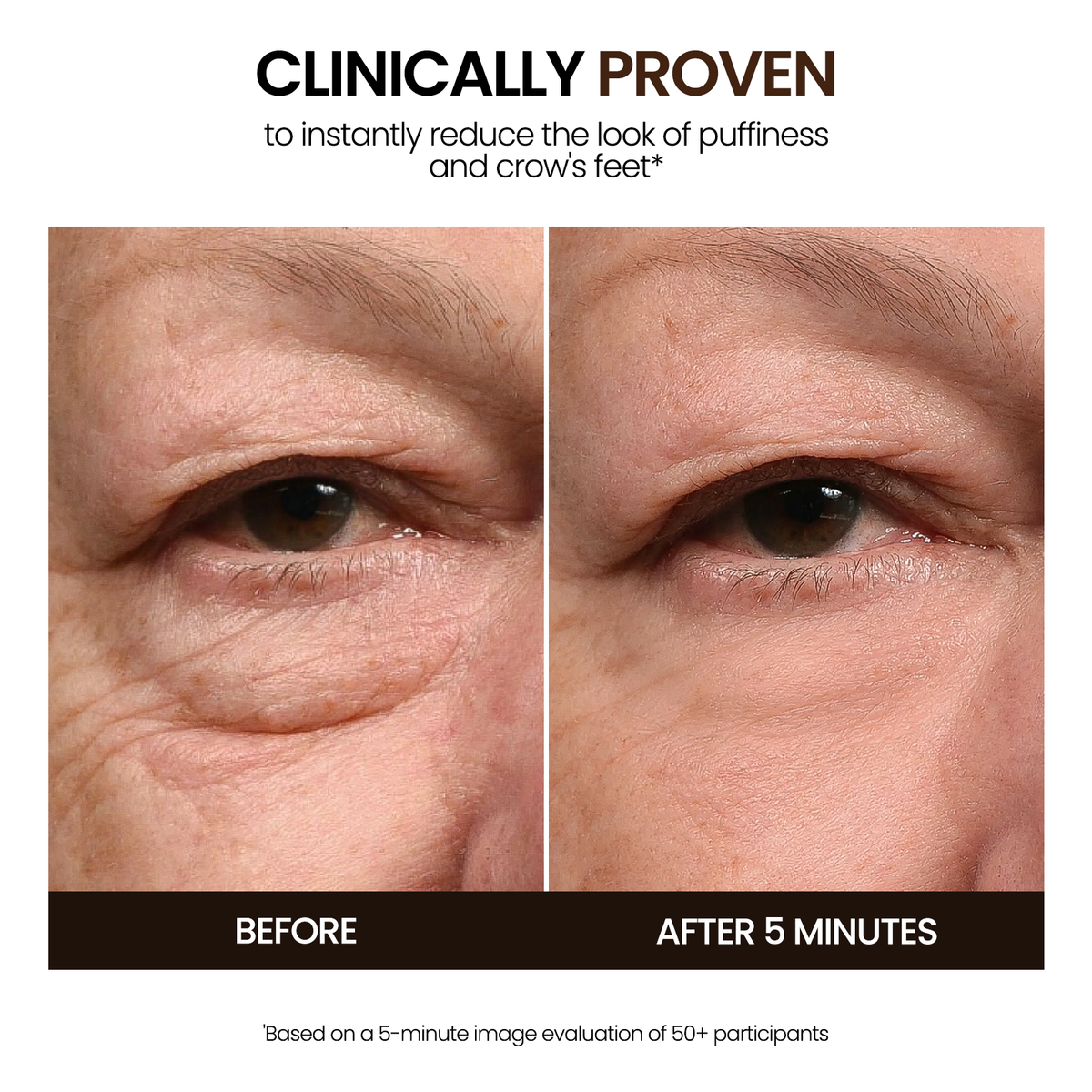 Loxadz Eye Cream -visibly reduces under-eye bags, puffiness, wrinkles & dark circles in minutes - 0.68 Oz