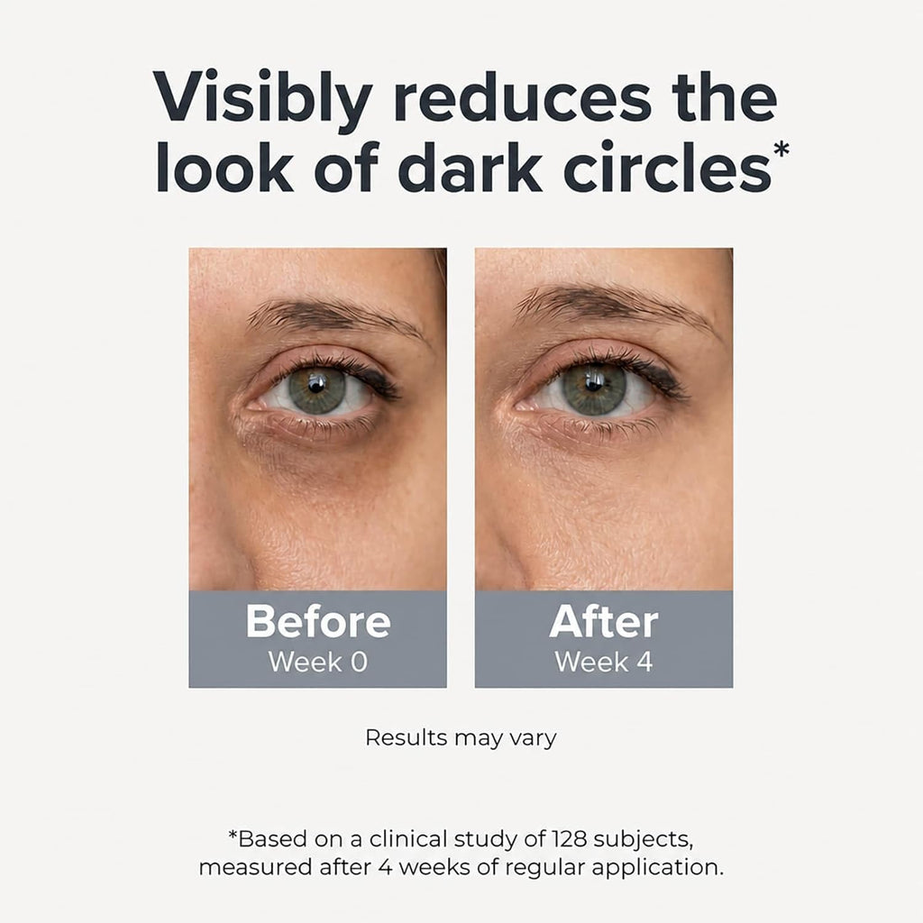 Under Eye Brightener Roller - Caffeine & Retinol Eye Serum for Dark Circles | Targets Puffiness & Fine Lines, Travel Essential Vegan Skincare, Cooling Eye Massage, Dermatologist-Tested, 0.52 fl oz